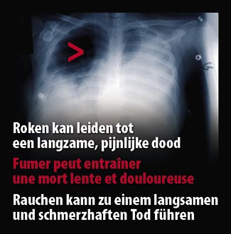 Belgium 2007 Health Effects death - internal image